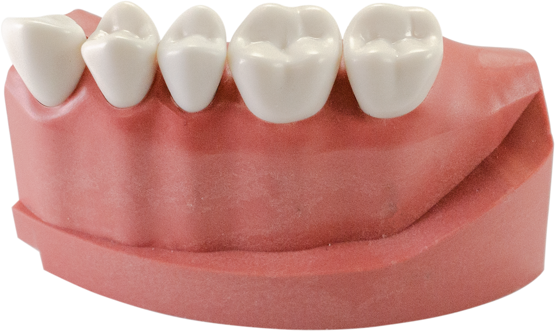 Acadental # AT02-06
