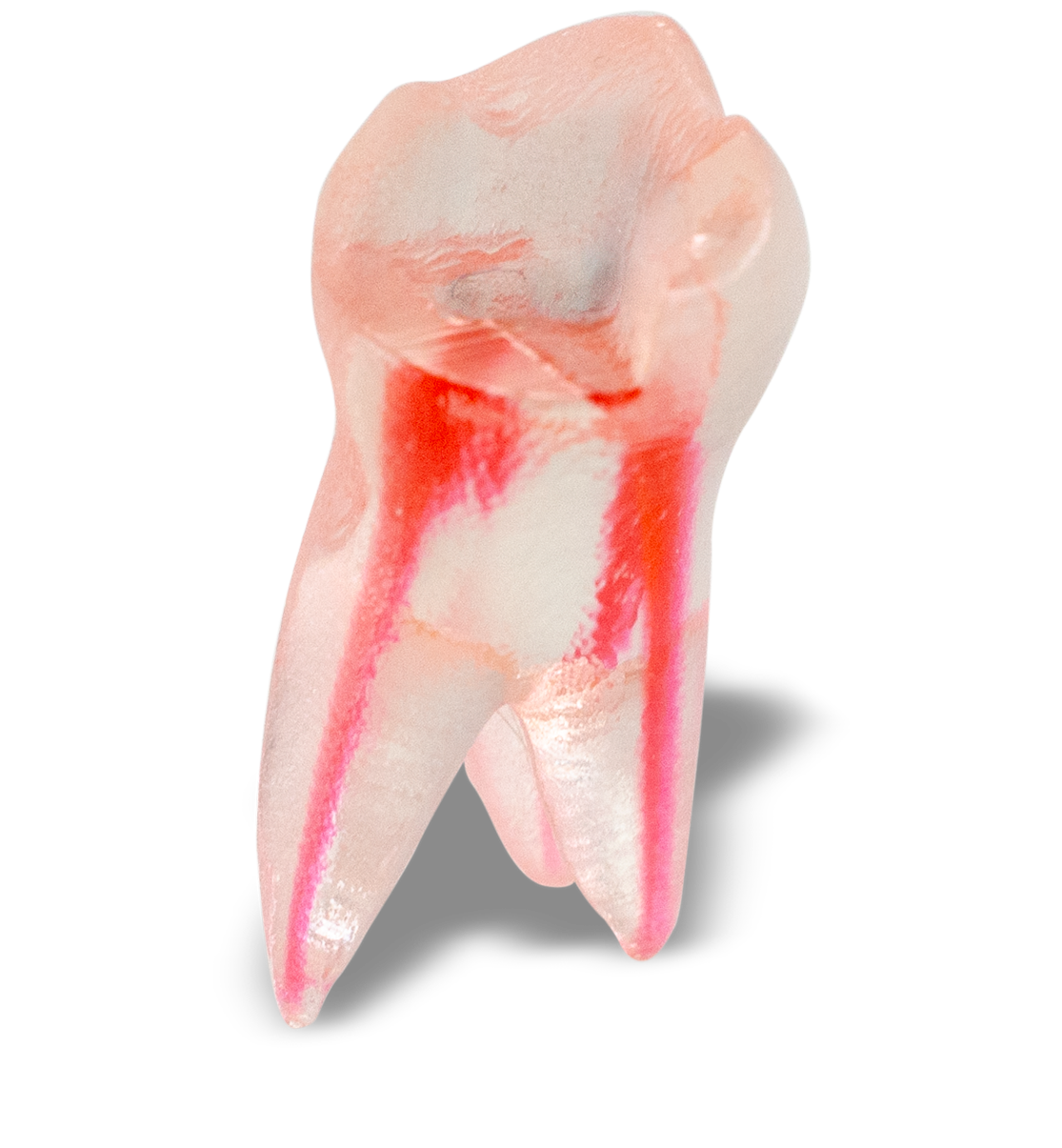 Acadental # IV-EP-ENDO-9
