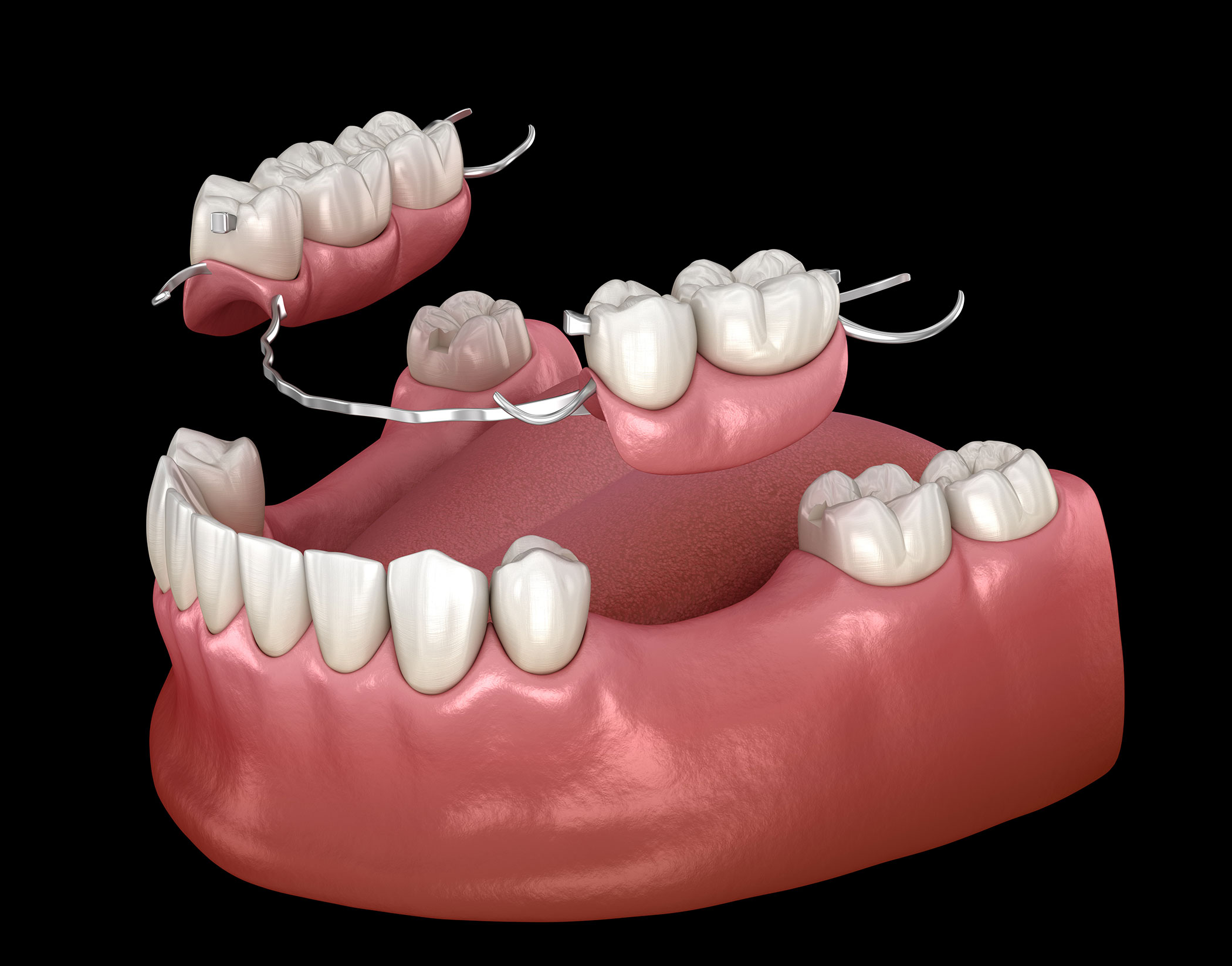 American Dental Assoc # W106