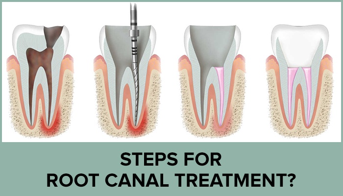 American Dental Assoc # W117