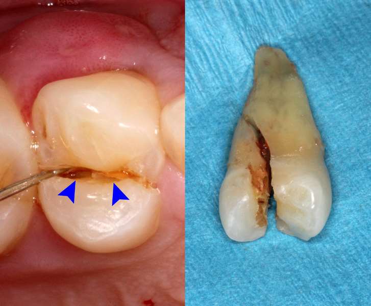 American Dental Assoc # W131