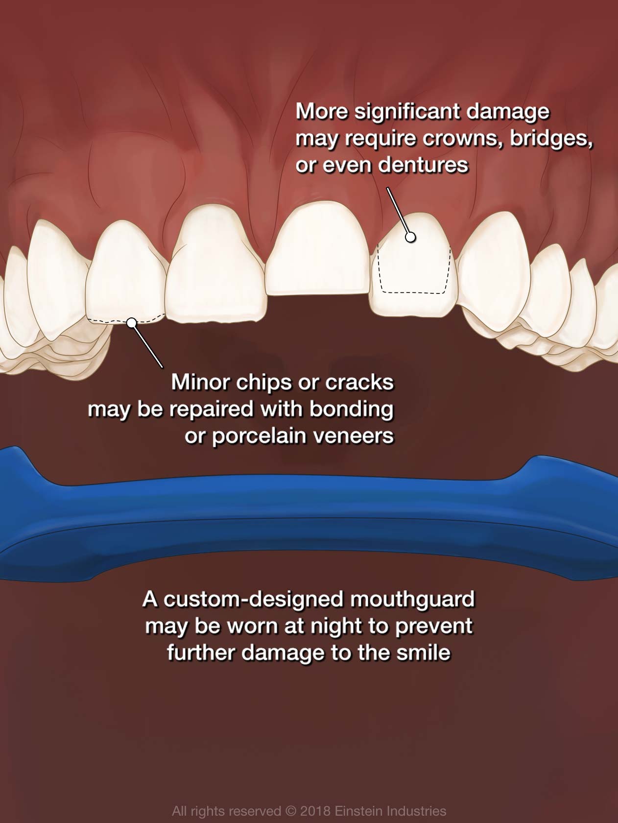 American Dental Assoc # W164