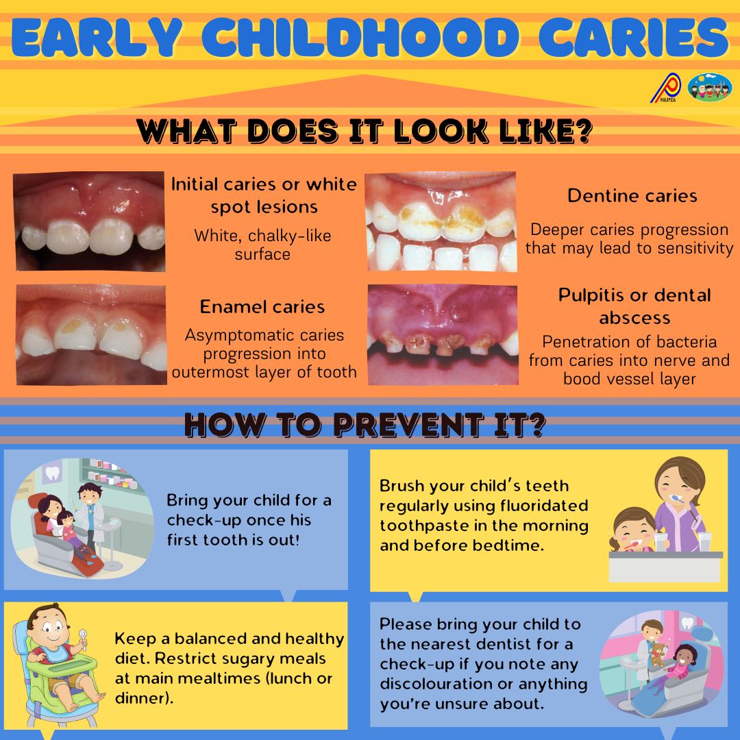 American Dental Assoc # W166