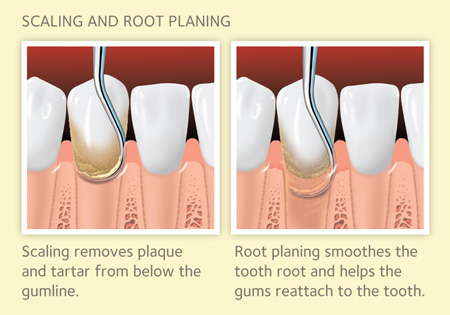 American Dental Assoc # W613