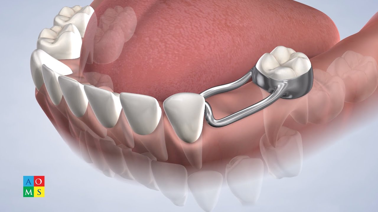 American Dental Supply # D750-6-YW