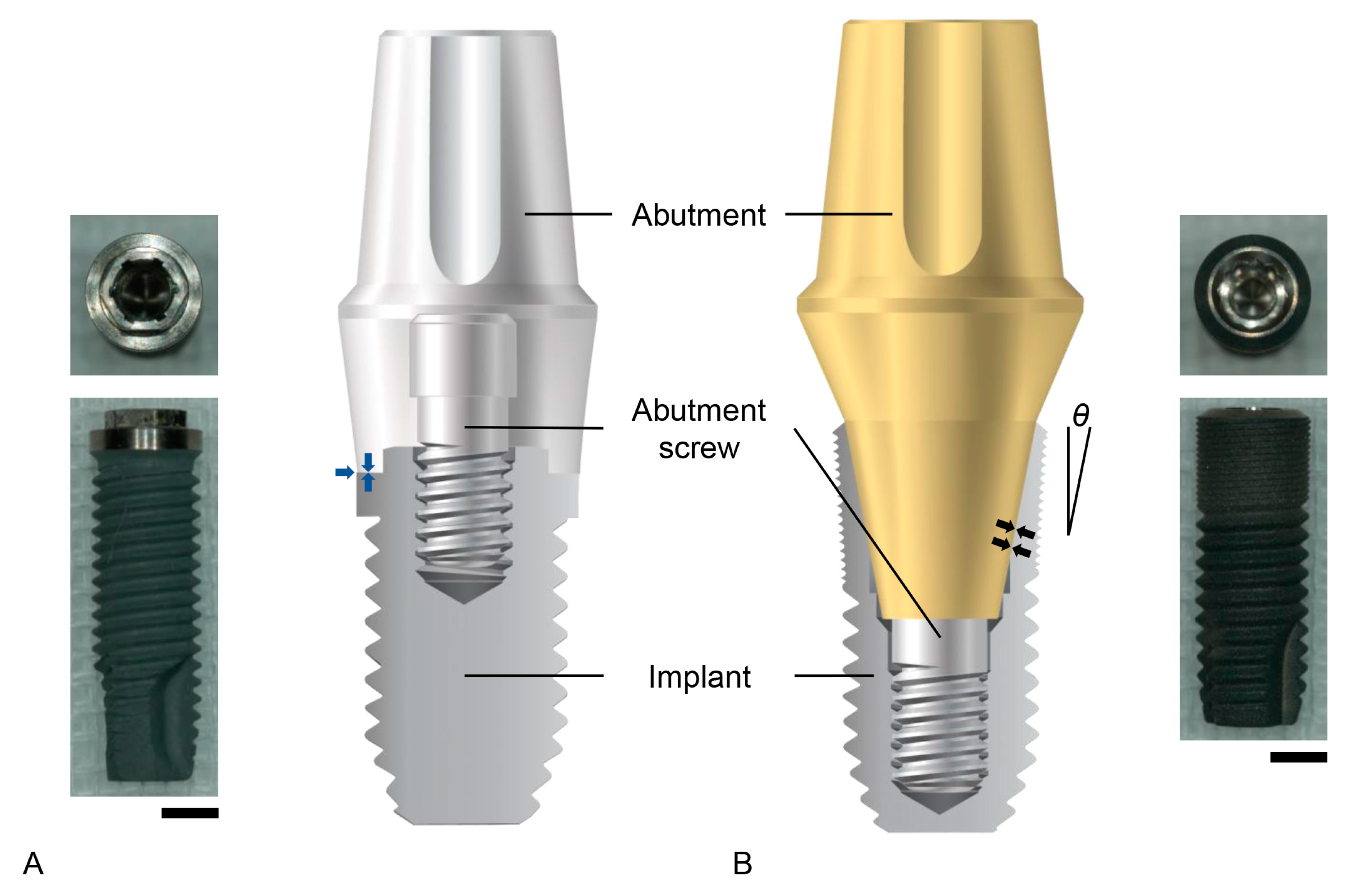 American Dental Supply # SM-45