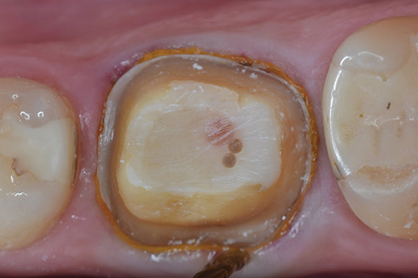 Clinician's Choice Dental # 024426W