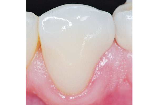Clinician's Choice Dental # 131506