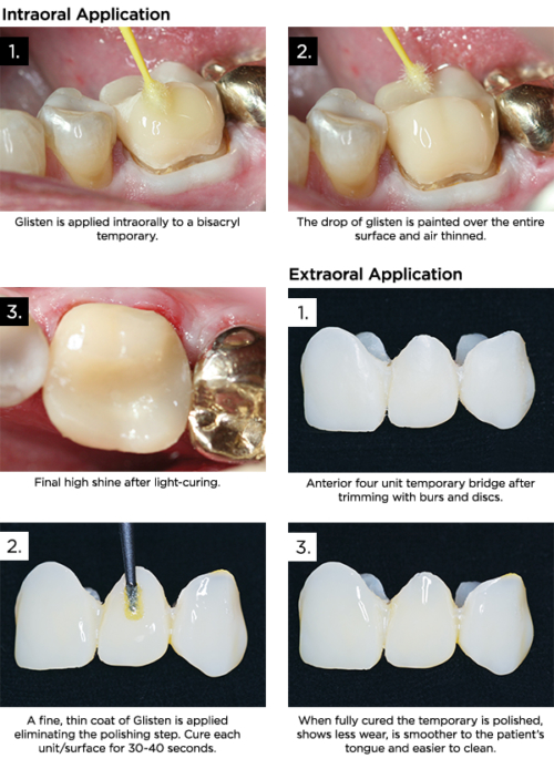 Clinician's Choice Dental # 151207