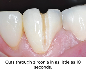 Clinician's Choice Dental # 3309827