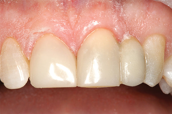Clinician's Choice Dental # 415506