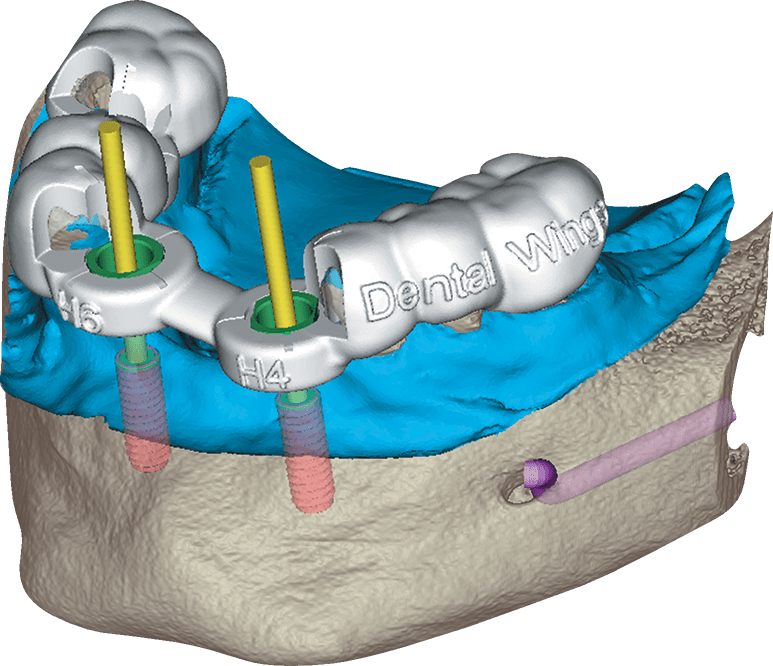 D Amann Gmbh # 217483