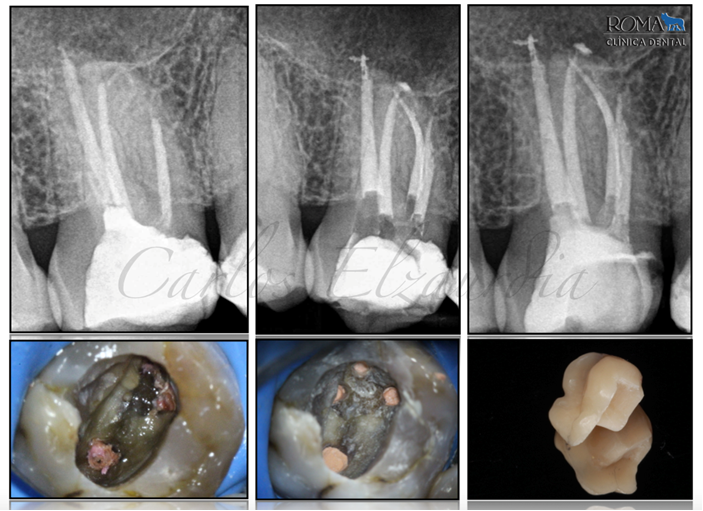 Dental Arte # MB2