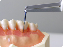 Florida Probe # FPSTIP