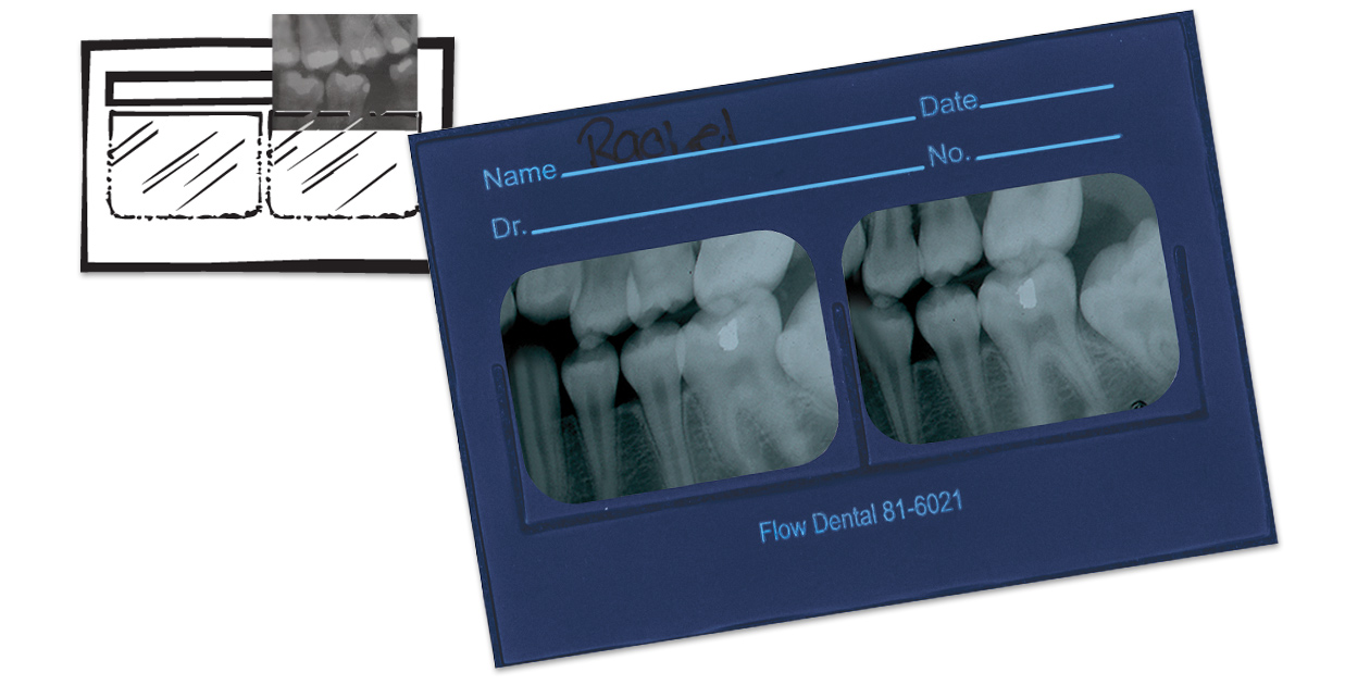 Flow X-Ray # 81-6040