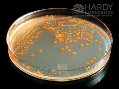 Hardy Diagnostics # G123