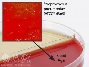 Hardy Diagnostics # J119