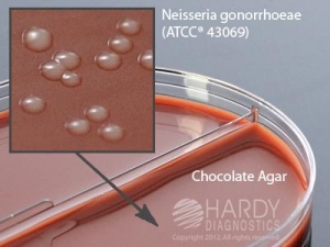 Hardy Diagnostics # J72