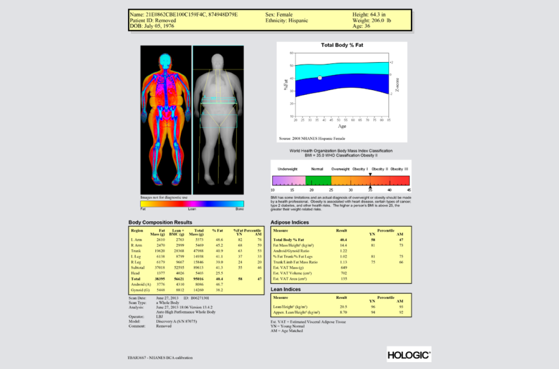 Hologic # BCA-SOFTWARE
