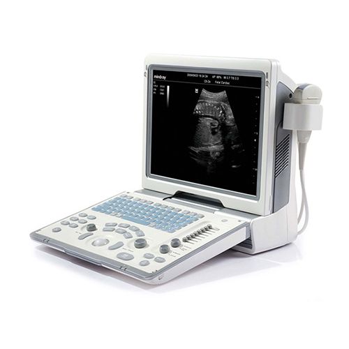 MDPro # SOLOSCAN P50