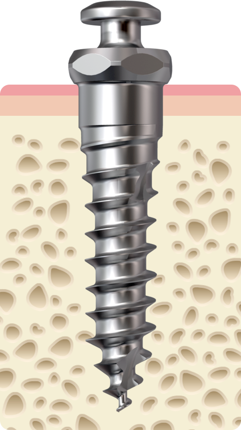Ortho Organizers # 3400-101
