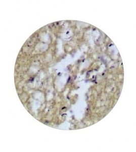 Statlab Medical Products # SSK-GRAM