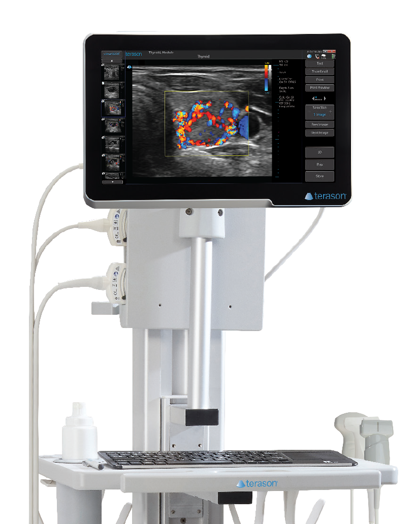 Terason Ultrasound # 335187