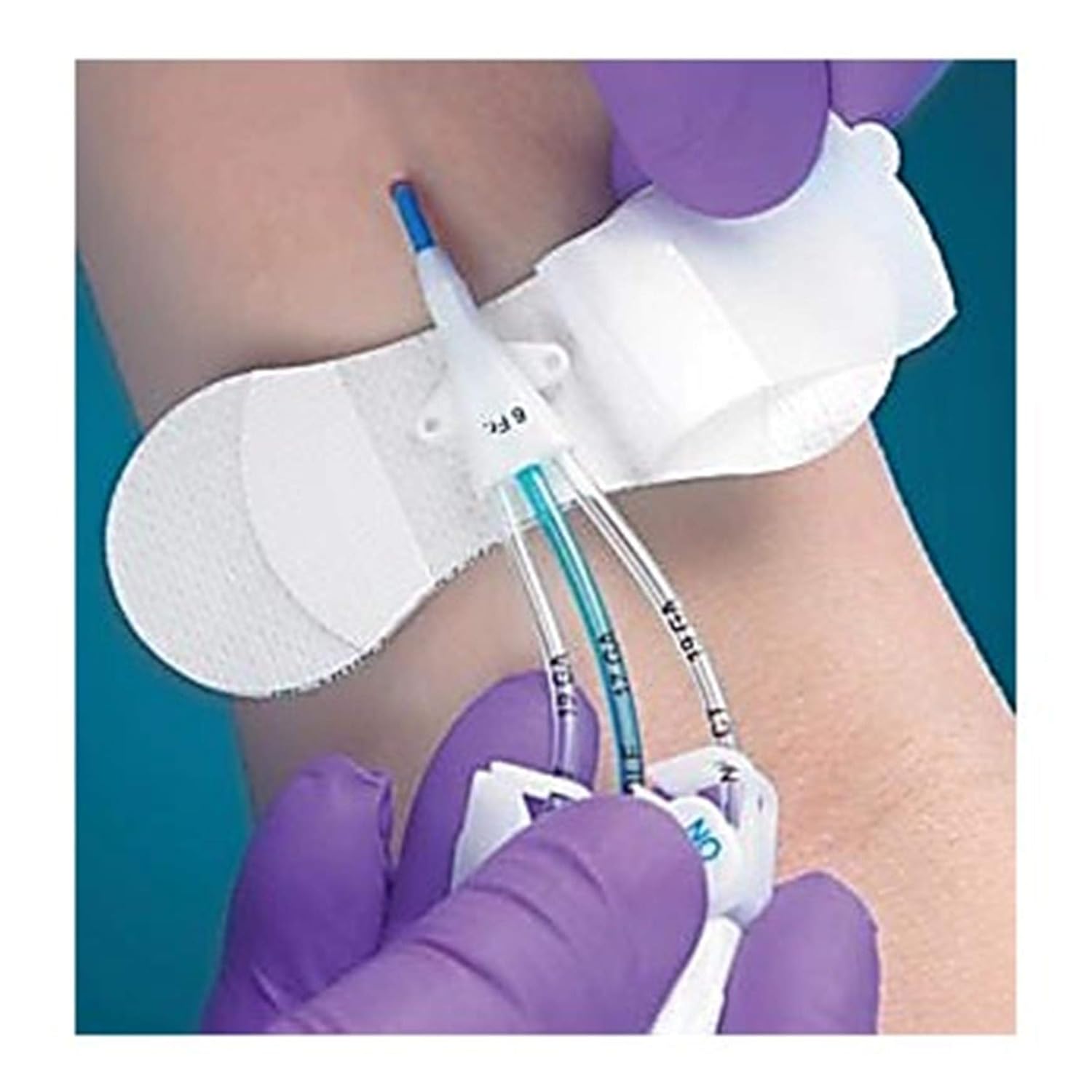 TIDI Products # 3304MCS-BA