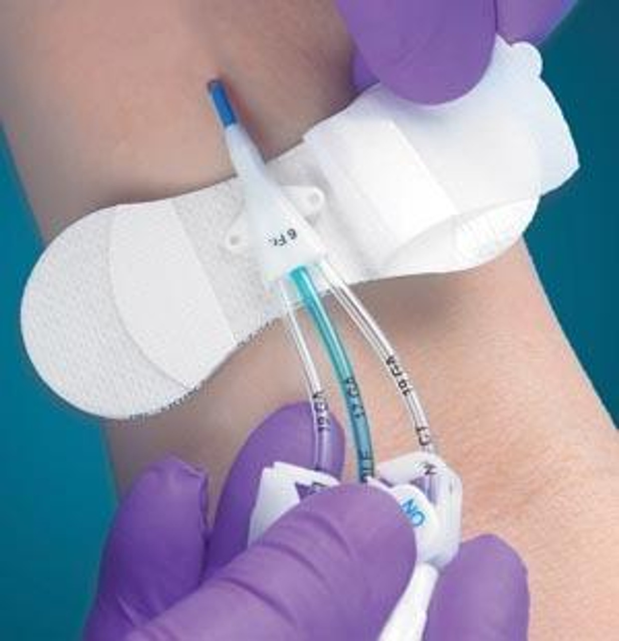 TIDI Products # 3360MWA