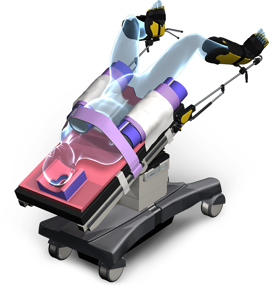 Xodus Medical # 40595