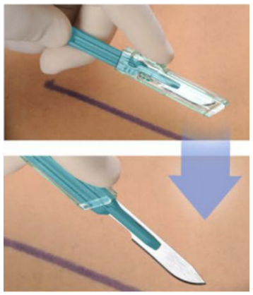 Xodus Medical # 90211